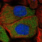 Immunofluorescent staining of human cell line A-431 shows localization to cytosol.