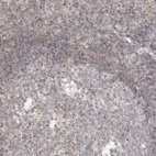 Immunohistochemical staining of human tonsil shows weak cytoplasmic positivity in non-germinal center cells.