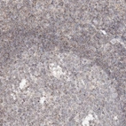 Immunohistochemical staining of human tonsil shows weak cytoplasmic positivity in non-germinal center cells.