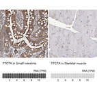 Immunohistochemistry analysis in human small intestine and skeletal muscle tissues using HPA036782 antibody. Corresponding TTC7A RNA-seq data are presented for the same tissues.
