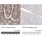 Immunohistochemistry analysis in human small intestine and skeletal muscle tissues using HPA036782 antibody. Corresponding TTC7A RNA-seq data are presented for the same tissues.
