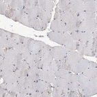 Immunohistochemical staining of human skeletal muscle shows no positivity in myocytes as expected.