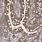 Immunohistochemical staining of human small intestine shows strong cytoplasmic positivity in glandular cells.