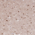 Anti-TCF20 Antibody