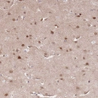 Anti-TCF20 Antibody