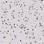 Anti-ZNF638 Antibody
