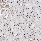 Immunohistochemical staining of human kidney shows strong nuclear positivity in cells in tubules.