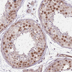 Immunohistochemical staining of human testis shows moderate nuclear positivity in cells in seminiferous ducts.