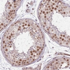 Immunohistochemical staining of human testis shows moderate nuclear positivity in cells in seminiferous ducts.