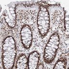Immunohistochemical staining of human colon shows strong nuclear positivity in glandular cells.