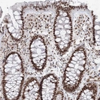 Immunohistochemical staining of human colon shows strong nuclear positivity in glandular cells.