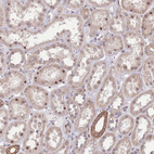 Immunohistochemical staining of human kidney shows weak nuclear positivity in subset of cells in tubules.