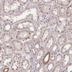 Immunohistochemical staining of human kidney shows weak nuclear positivity in subset of cells in tubules.