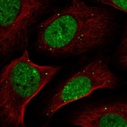 Immunofluorescent staining of human cell line U-2 OS shows localization to nucleoplasm & vesicles.