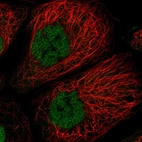 Immunofluorescent staining of human cell line A-431 shows localization to nucleoplasm.