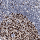 Immunohistochemical staining of human lymph node shows strong nuclear positivity in germinal center cells.