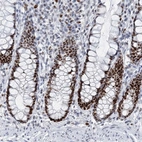 Immunohistochemical staining of human rectum shows strong nuclear positivity in glandular cells.