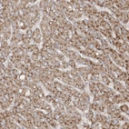 Anti-SH3BP2 Antibody