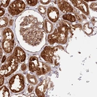 Anti-PPP1R21 Antibody