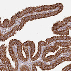 Immunohistochemical staining of human fallopian tube shows strong membranous positivity in glandular cells.