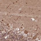 Immunohistochemical staining of human cerebellum shows strong cytoplasmic positivity in Purkinje cells and dendritic cells.