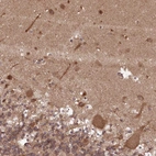Immunohistochemical staining of human cerebellum shows strong cytoplasmic positivity in Purkinje cells and dendritic cells.