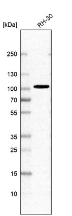 Western blot analysis in human cell line RH-30.