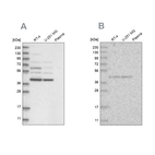 Western blot analysis using Anti-GPN1 antibody HPA036793 (A) shows similar pattern to independent antibody HPA036794 (B).