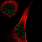 Anti-TEX15 Antibody