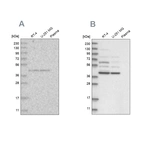 Western blot analysis using Anti-GPN1 antibody HPA036794 (A) shows similar pattern to independent antibody HPA036793 (B).