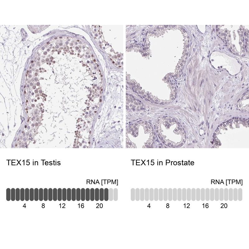 Anti-TEX15 Antibody