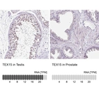 Anti-TEX15 Antibody