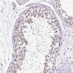 Immunohistochemical staining of human testis shows high expression.