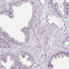 Immunohistochemical staining of human prostate shows low expression as expected.