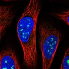 Immunofluorescent staining of human cell line U-2 OS shows localization to nucleoli.