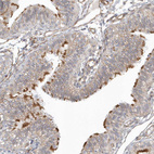 Anti-DNAH1 Antibody