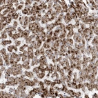 Immunohistochemical staining of human liver shows strong cytoplasmic granular positivity in hepatocytes.