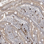 Immunohistochemical staining of human duodenum shows cytoplasmic-membranous positivity in glandular cells.