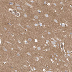 Immunohistochemical staining of human cerebral cortex shows moderate cytoplasmic positivity in neuropil.