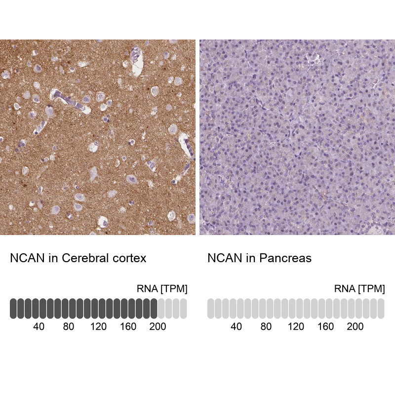 Anti-NCAN Antibody