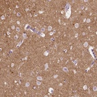 Immunohistochemical staining of human cerebral cortex shows high expression.