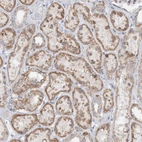 Immunohistochemical staining of human kidney shows moderate cytoplasmic positivity in cells in tubules.