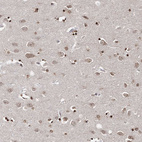 Immunohistochemical staining of human cerebral cortex shows weak cytoplasmic positivity in neurons.