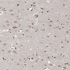 Immunohistochemical staining of human cerebral cortex shows weak cytoplasmic positivity in neurons.