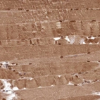 Immunohistochemical staining of human skeletal muscle shows strong cytoplasmic positivity in myocytes.