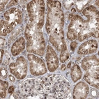 Immunohistochemical staining of human kidney shows strong cytoplasmic positivity in cells in tubules.