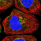 Immunofluorescent staining of human cell line A-431 shows localization to cytosol & the Golgi apparatus.