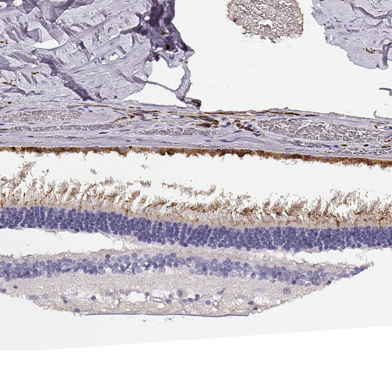 Anti-CDHR1 Antibody