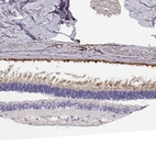Anti-CDHR1 Antibody