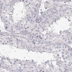 Immunohistochemical staining of human testis shows no positivity in cells in seminiferous ducts as expected.